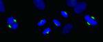 ASPM Antibody in Immunocytochemistry (ICC/IF)