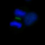 INCENP Antibody in Immunocytochemistry (ICC/IF)