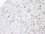 MCM3 Antibody in Immunohistochemistry (Paraffin) (IHC (P))