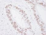 MCM3 Antibody in Immunohistochemistry (Paraffin) (IHC (P))