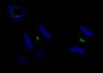 PLK1 Antibody in Immunocytochemistry (ICC/IF)