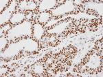 KAP-1 Antibody in Immunohistochemistry (Paraffin) (IHC (P))