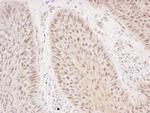 Rad50 Antibody in Immunohistochemistry (Paraffin) (IHC (P))