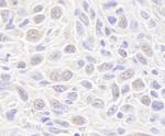 Rad50 Antibody in Immunohistochemistry (Paraffin) (IHC (P))