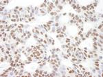 Bcl11b Antibody in Immunohistochemistry (Paraffin) (IHC (P))