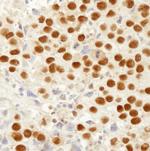 MSH2 Antibody in Immunohistochemistry (Paraffin) (IHC (P))