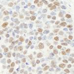 MSH2 Antibody in Immunohistochemistry (Paraffin) (IHC (P))