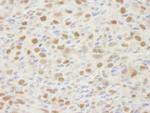 MSH2 Antibody in Immunohistochemistry (Paraffin) (IHC (P))