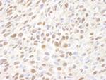 VCP Antibody in Immunohistochemistry (Paraffin) (IHC (P))