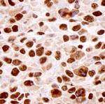 hnRNP-K Antibody in Immunohistochemistry (Paraffin) (IHC (P))