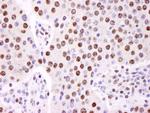 hnRNP-K Antibody in Immunohistochemistry (Paraffin) (IHC (P))