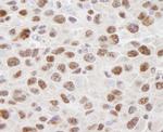 hnRNP-U Antibody in Immunohistochemistry (Paraffin) (IHC (P))