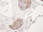 hnRNP-U Antibody in Immunohistochemistry (Paraffin) (IHC (P))