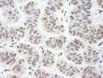 GNL3 Antibody in Immunohistochemistry (Paraffin) (IHC (P))