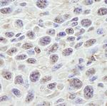 GNL3 Antibody in Immunohistochemistry (Paraffin) (IHC (P))