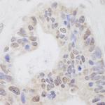 RNF40 Antibody in Immunohistochemistry (Paraffin) (IHC (P))