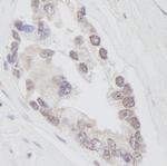 RNF40 Antibody in Immunohistochemistry (Paraffin) (IHC (P))