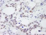 NUP214 Antibody in Immunohistochemistry (Paraffin) (IHC (P))