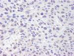 ASH2 Antibody in Immunohistochemistry (Paraffin) (IHC (P))