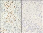 Phospho-XRCC1 (Ser518, Thr519, Thr523) Antibody in Immunohistochemistry (Paraffin) (IHC (P))