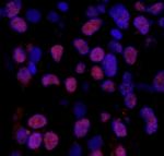 Phospho-XRCC1 (Ser518, Thr519, Thr523) Antibody in Immunohistochemistry (Paraffin) (IHC (P))