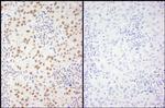 Phospho-XRCC1 (Ser461) Antibody in Immunohistochemistry (Paraffin) (IHC (P))