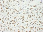 Phospho-XRCC1 (Ser461) Antibody in Immunohistochemistry (Paraffin) (IHC (P))