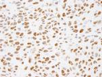 Phospho-XRCC1 (Ser485,Thr488) Antibody in Immunohistochemistry (Paraffin) (IHC (P))