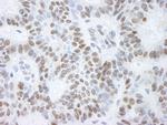 BHC110/LSD1 Antibody in Immunohistochemistry (Paraffin) (IHC (P))