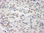 BHC110/LSD1 Antibody in Immunohistochemistry (Paraffin) (IHC (P))