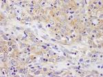 BIRC6/Apollon Antibody in Immunohistochemistry (Paraffin) (IHC (P))