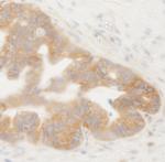 BIRC6/Apollon Antibody in Immunohistochemistry (Paraffin) (IHC (P))