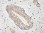 4E-T/eIF4E-T Antibody in Immunohistochemistry (Paraffin) (IHC (P))