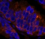 4E-T/eIF4E-T Antibody in Immunohistochemistry (Paraffin) (IHC (P))