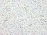 CDT1 Antibody in Immunohistochemistry (Paraffin) (IHC (P))