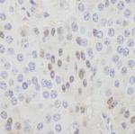 CDT1 Antibody in Immunohistochemistry (Paraffin) (IHC (P))