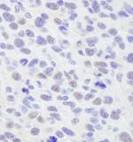 SMAR1/BANP Antibody in Immunohistochemistry (Paraffin) (IHC (P))