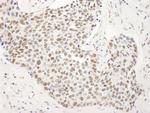 SMAR1/BANP Antibody in Immunohistochemistry (Paraffin) (IHC (P))