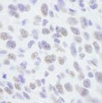 SAFB1 Antibody in Immunohistochemistry (Paraffin) (IHC (P))