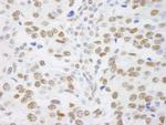 SAFB1 Antibody in Immunohistochemistry (Paraffin) (IHC (P))