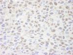 Sin3A Antibody in Immunohistochemistry (Paraffin) (IHC (P))