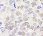 TIF1 Alpha/TRIM24 Antibody in Immunohistochemistry (Paraffin) (IHC (P))