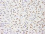 TIF1 Alpha/TRIM24 Antibody in Immunohistochemistry (Paraffin) (IHC (P))