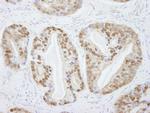 PRMT5 Antibody in Immunohistochemistry (Paraffin) (IHC (P))