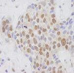 MED1 Antibody in Immunohistochemistry (Paraffin) (IHC (P))