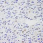 MED1 Antibody in Immunohistochemistry (Paraffin) (IHC (P))