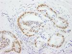 DDX5 Antibody in Immunohistochemistry (Paraffin) (IHC (P))