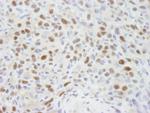 RbBP7 Antibody in Immunohistochemistry (Paraffin) (IHC (P))