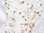 Coronin 1 Antibody in Immunohistochemistry (Paraffin) (IHC (P))