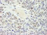 HMG2a Antibody in Immunohistochemistry (Paraffin) (IHC (P))